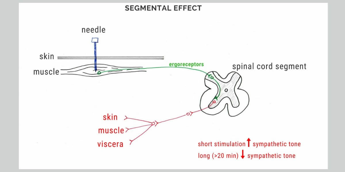 Acupuncture Explained - Tell me more - Segmental effect
